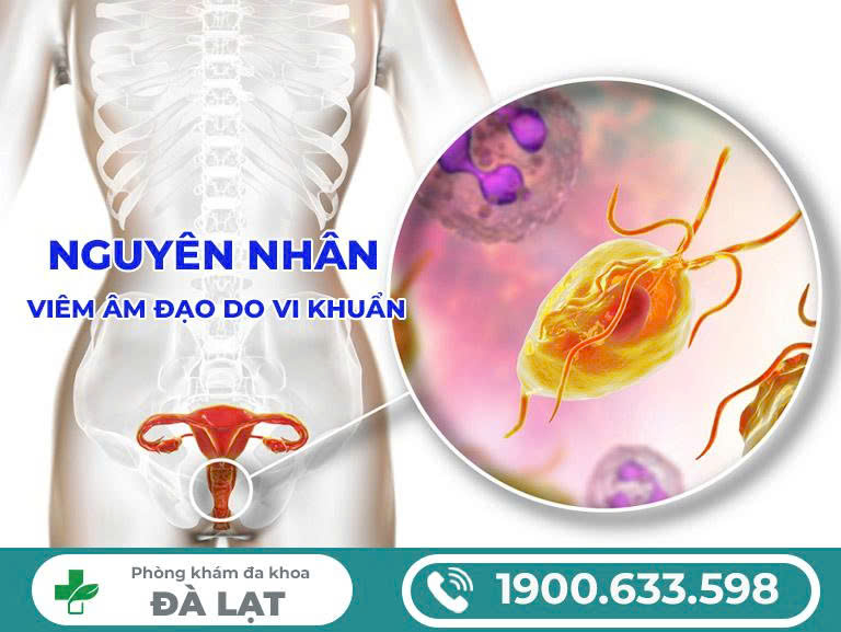 Hình ảnh minh họa